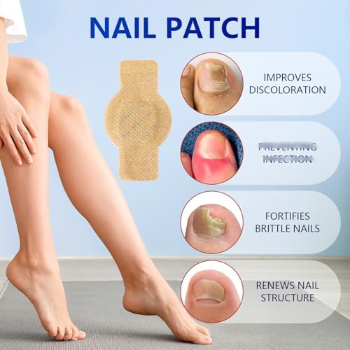 Before and after comparison of thick discolored nails renewing with eight hour nighttime care
