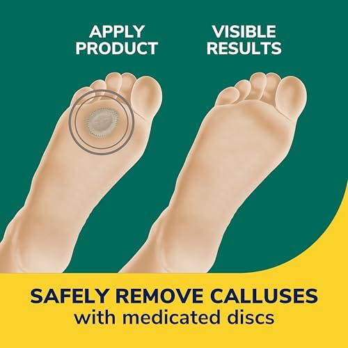 Side view of thick protective cushions for foot pain relief from shoe friction