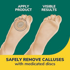 Side view of thick protective cushions for foot pain relief from shoe friction