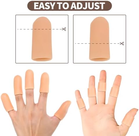 Elastic finger support gloves being worn to relieve hand arthritis pain while typing.