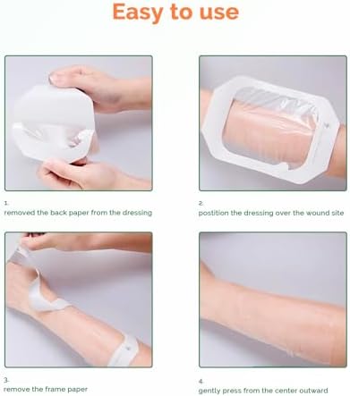Large transparent film dressing dimensions and frame style view