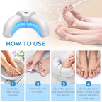Portable ZZP nail therapy machine for treating multiple toenails simultaneously.