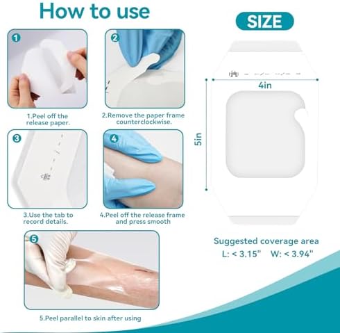 Breathable polyurethane film dressing protecting an IV site from water