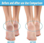 A complete set of 12 replacement rollers for professional at-home foot care.
