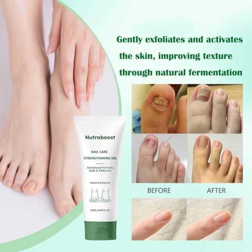 Before and after comparison mockup showing hydrated, shiny nails after using the cuticle serum.