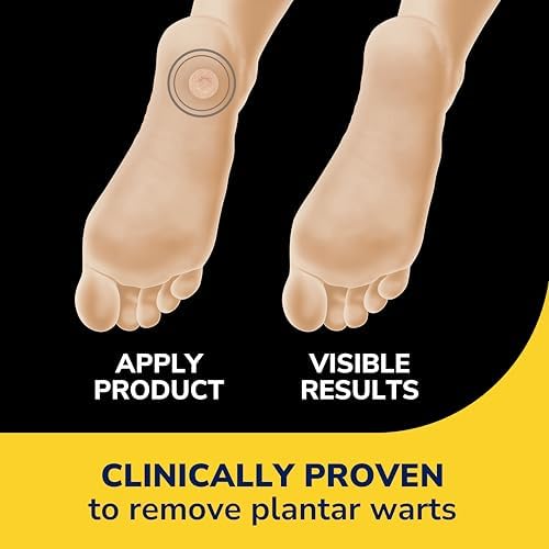 Back of package showing instructions for maximum strength salicylic acid wart treatment.