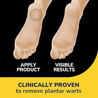 Back of package showing instructions for maximum strength salicylic acid wart treatment.