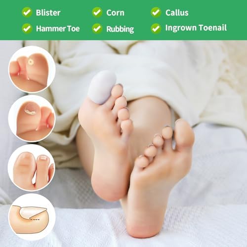 Medical grade gel toe sleeves applied to a foot for corn protection.