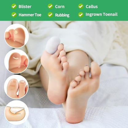Medical grade gel toe sleeves applied to a foot for corn protection.