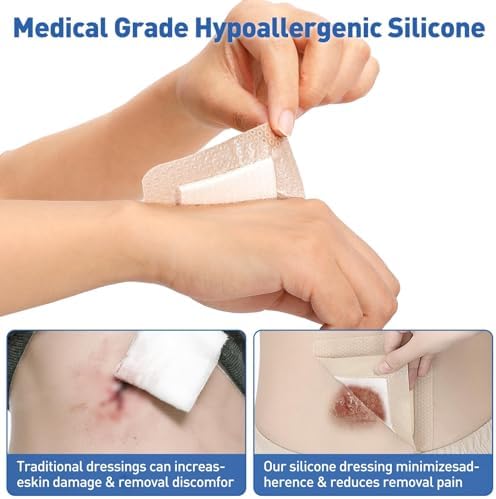 AZEN large self adhesive wound dressings demonstrating the flexible border adhesive.