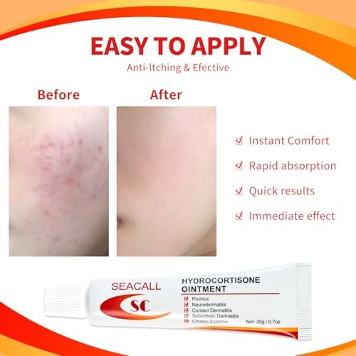Seacall topical hydrocortisone cream showing net weight of 0.7 ounce.