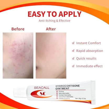 Seacall topical hydrocortisone cream showing net weight of 0.7 ounce.