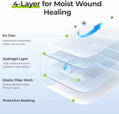 Three pack of AUVON hydrogel wound dressings for professional burn care.