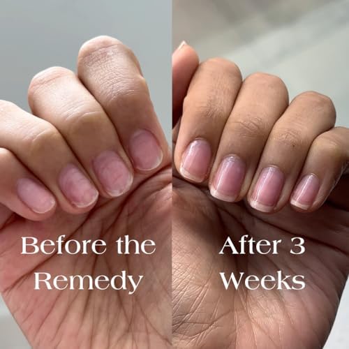 Botanist The Remedy nail strengthening formula ingredients label