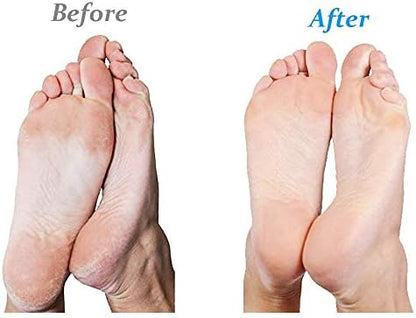 Authentic Emjoi Micro-Pedi Ultra packaging for professional foot care