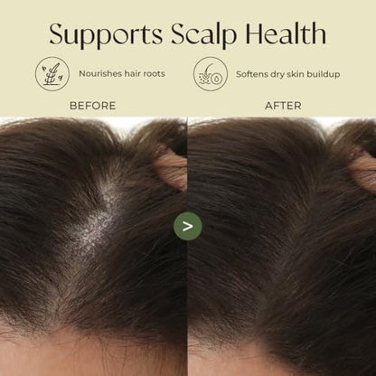 Close up of Gya Labs rosemary hair treatment for postpartum thinning solutions.