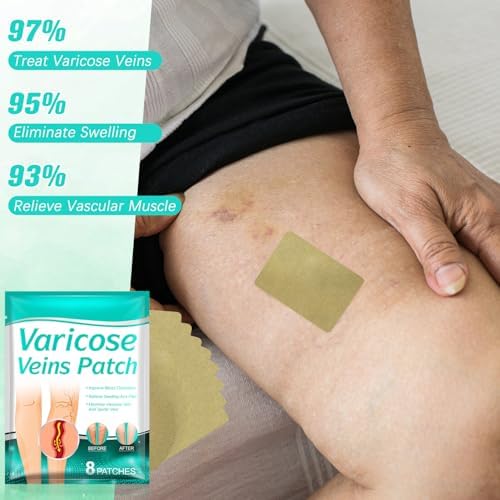 Before and after digital illustration representing improved cosmetic appearance of spider veins on legs.