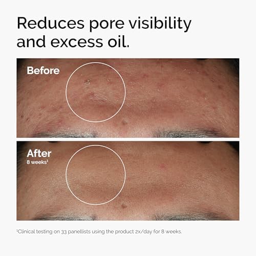 Vitamin B3 face serum for sebum control and balanced complexion