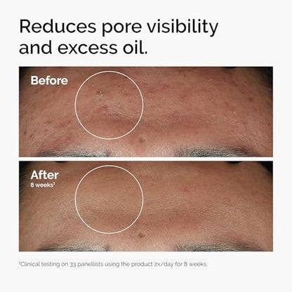 Vitamin B3 face serum for sebum control and balanced complexion