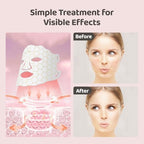 Side profile of the white Yahi rechargeable photon skincare mask showcasing the adjustable straps and neck attachment.