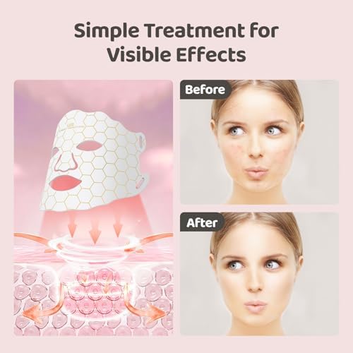 Side profile of the white Yahi rechargeable photon skincare mask showcasing the adjustable straps and neck attachment.