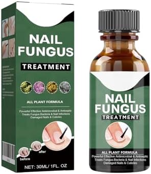 Close up of nail fungus liquid bottle for hand and foot care