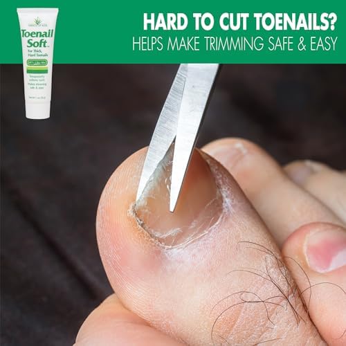 Toenail softening cream being applied to a thick nail for overnight treatment.