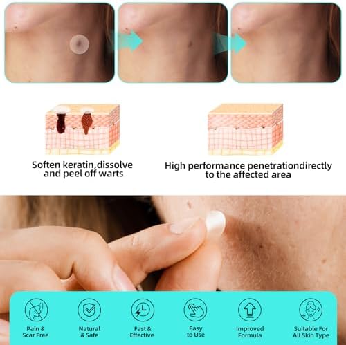 Close up of invisible hydrocolloid stickers for skin tag removal.