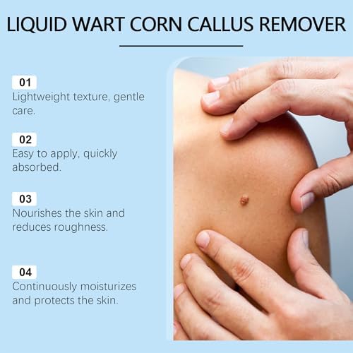 Authentic USA imported mole and wart removal solution for men and women.