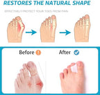 Close up of soft flexible gel material of the Nolimvita hammer toe splint.