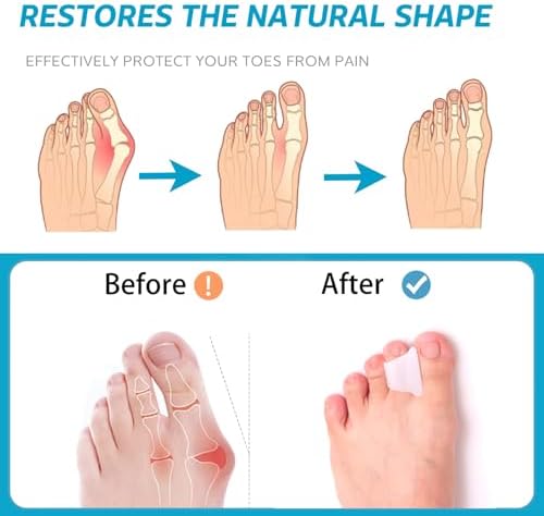 Close up of soft flexible gel material of the Nolimvita hammer toe splint.