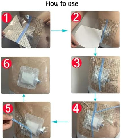 Close up of 10 x 12 centimeter waterproof dressing for ileostomy care.