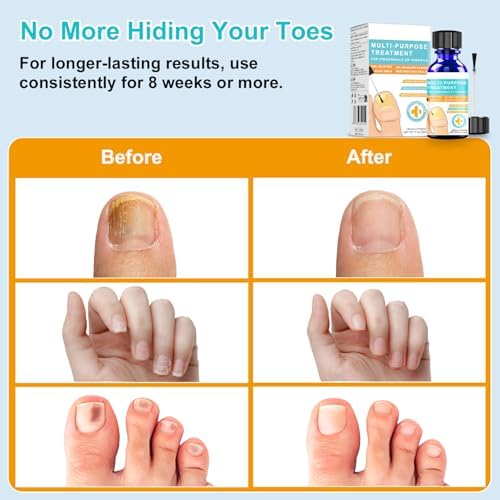 PreciseWell 30ml bottle showing ingredients for damaged nail restoration