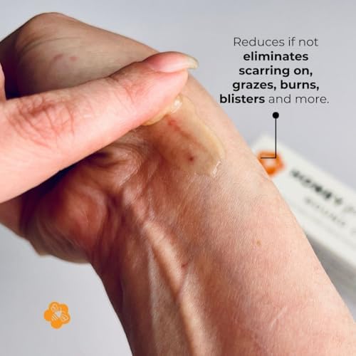 Natural first aid kit essential for rapid healing of scrapes and scars