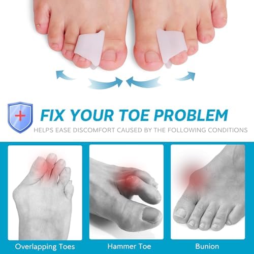 Pack of six Nolimvita beige gel toe correctors for men and women.