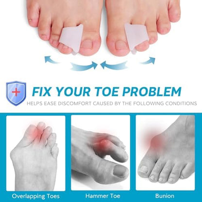 Pack of six Nolimvita beige gel toe correctors for men and women.