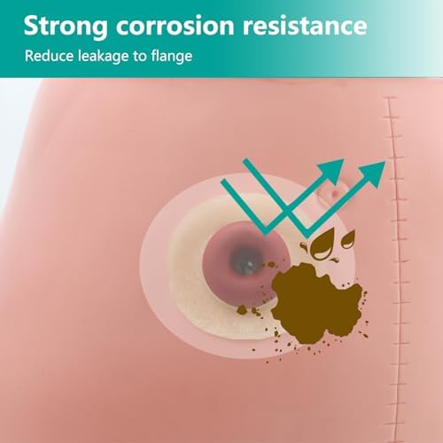 Vlookup barrier rings applied next to a colostomy bag system to showcase universal compatibility.