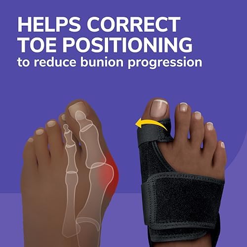 Close up of the massaging gel pad on the orthopedic bunion straightener.