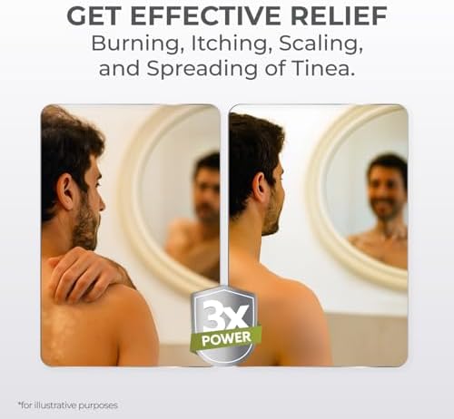 Terrasil Tinea Treatment Max tube for clearing fungal skin infections and ringworm.
