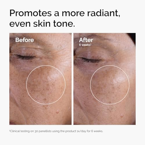 AHA exfoliating toner for uneven skin tone and texture improvement