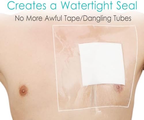 Transparent adhesive stoma bath protector shield film being applied.