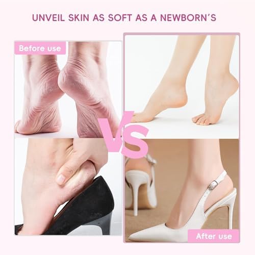 VOOYVEX pedicure tool showing the multi speed adjustment buttons for customized dead skin exfoliation