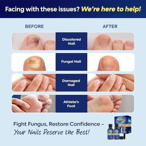 Tobcharm antifungal solution with tea tree oil and lavender for healthy nails
