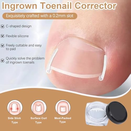 Detailed shot of the flexible curved patches designed for relieving pressure on painful ingrown toenails