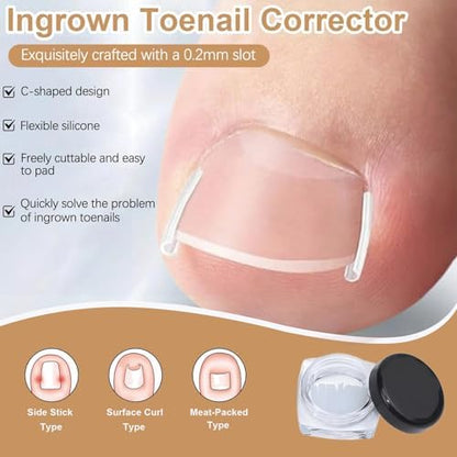 Detailed shot of the flexible curved patches designed for relieving pressure on painful ingrown toenails