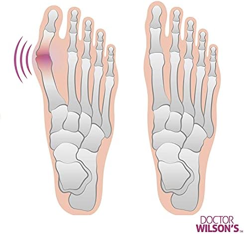 A pair of Ferenu bunion corrector socks displayed on a flat surface.