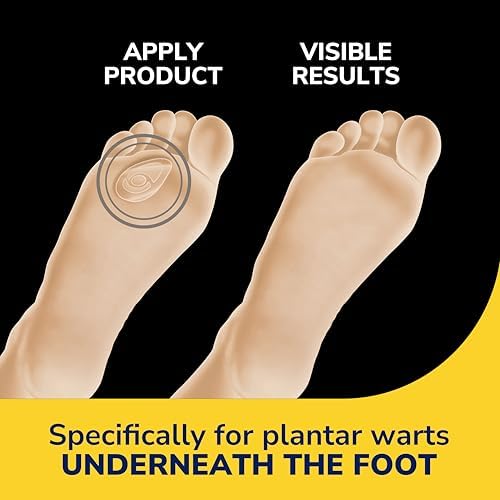 Dr. Scholl's triple layer hydrogel technology bandage application