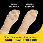 Dr. Scholl's triple layer hydrogel technology bandage application