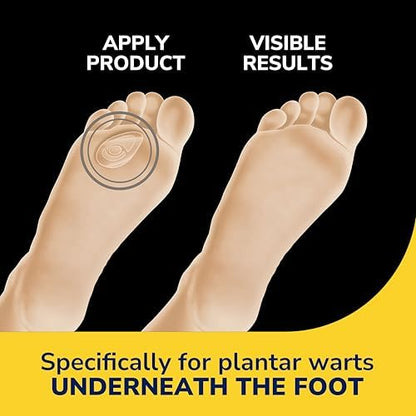 Dr. Scholl's triple layer hydrogel technology bandage application