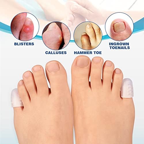 Stretchable gel toe sleeves demonstrating flexibility and material quality.